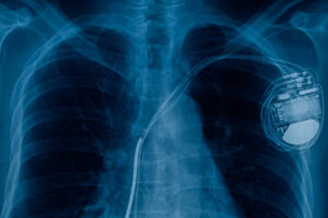 Read more about the article A funny story about pacemakers and church name tags